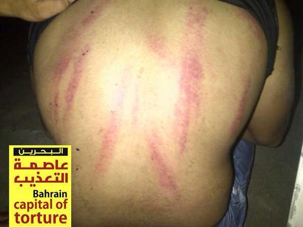 البحرين عاصمة التعذيب
